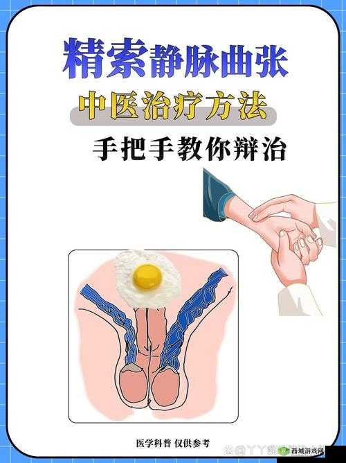 胡桃夹精索静脉曲张能治好吗：探寻其治疗的可能性与方法